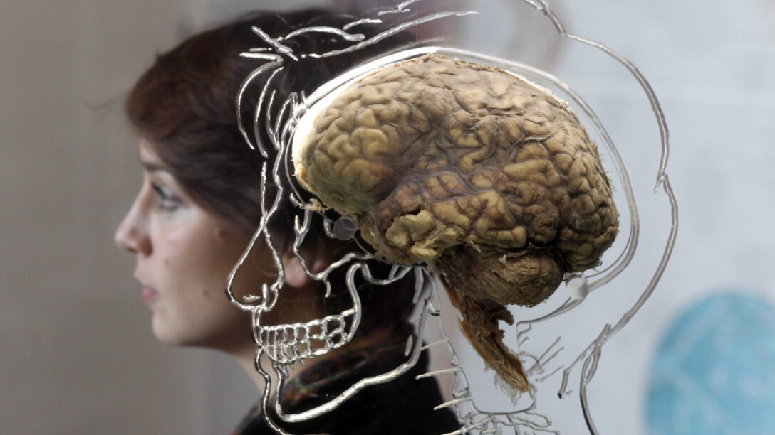 Human Brain